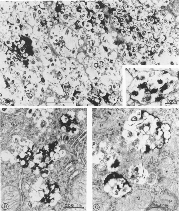 https://cdn.ncbi.nlm.nih.gov/pmc/blobs/264e/1916079/0e8b60456086/amjpathol00203-0028-a.jpg