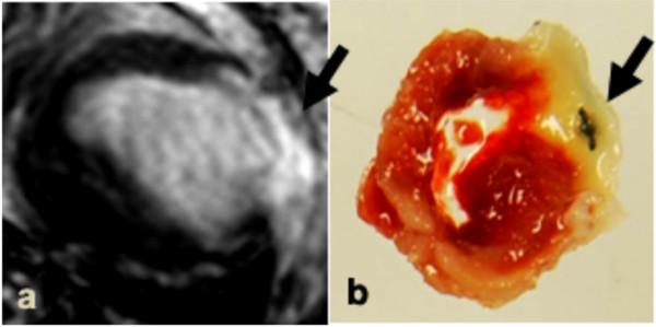 https://cdn.ncbi.nlm.nih.gov/pmc/blobs/2651/2244610/8718accc5a61/1532-429X-10-6-2.jpg