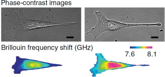 https://cdn.ncbi.nlm.nih.gov/pmc/blobs/2654/6624783/f0f38d4f7386/cr-2019-00019f_0007.jpg