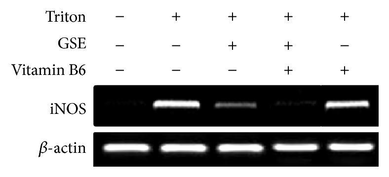 https://cdn.ncbi.nlm.nih.gov/pmc/blobs/2655/4884861/c3a6acf310b6/OMCL2016-8679506.001.jpg