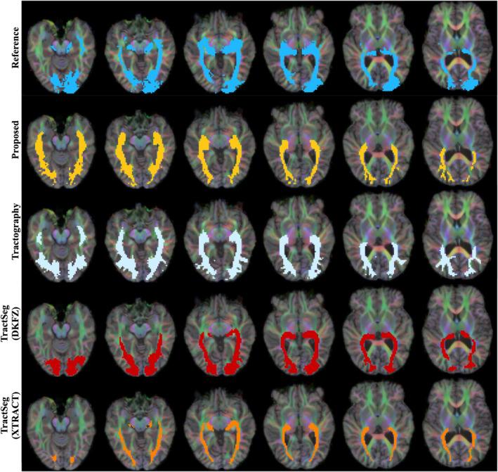 https://cdn.ncbi.nlm.nih.gov/pmc/blobs/2659/10826637/487f6c875163/HBM-45-e26578-g009.jpg