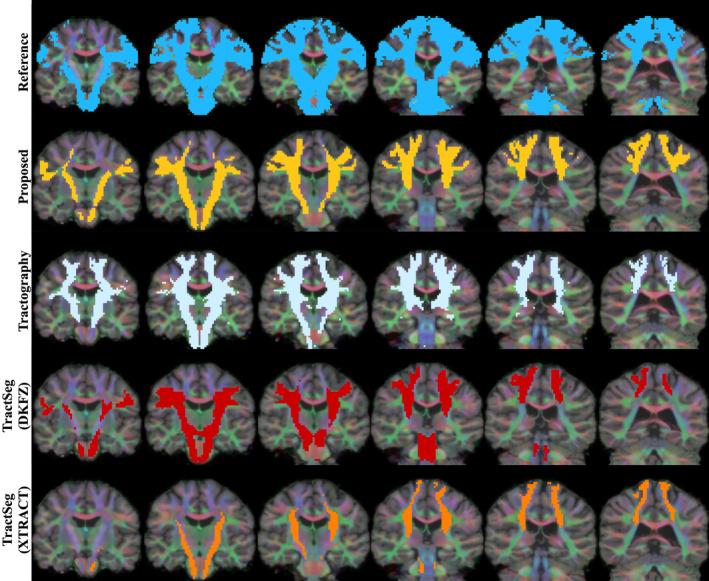 https://cdn.ncbi.nlm.nih.gov/pmc/blobs/2659/10826637/5b65c567e827/HBM-45-e26578-g010.jpg