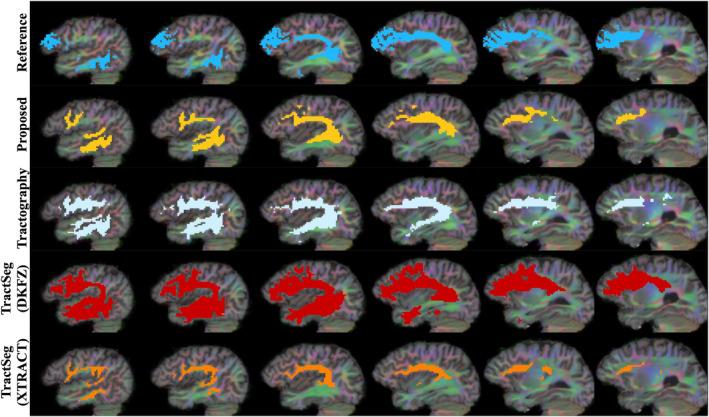 https://cdn.ncbi.nlm.nih.gov/pmc/blobs/2659/10826637/7af661338c3d/HBM-45-e26578-g002.jpg