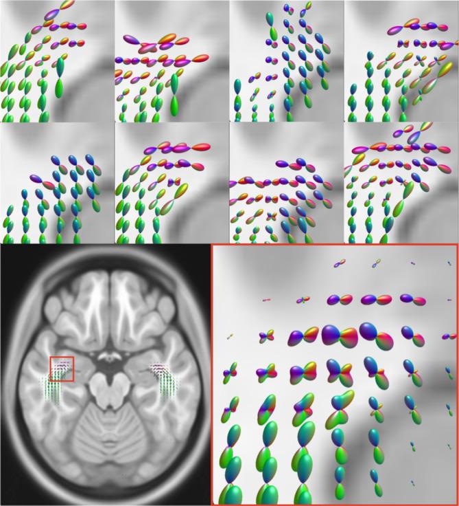 https://cdn.ncbi.nlm.nih.gov/pmc/blobs/2659/10826637/7f9174fade67/HBM-45-e26578-g003.jpg