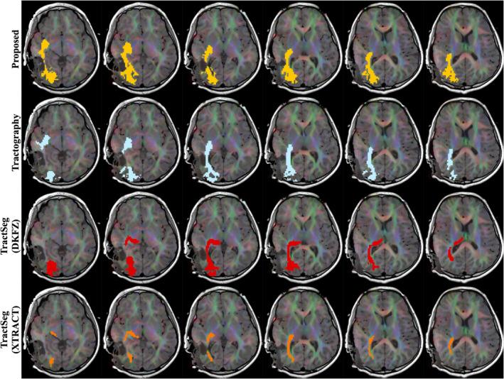 https://cdn.ncbi.nlm.nih.gov/pmc/blobs/2659/10826637/8b60050aa87b/HBM-45-e26578-g008.jpg