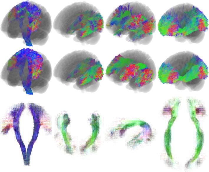https://cdn.ncbi.nlm.nih.gov/pmc/blobs/2659/10826637/c98155b751f8/HBM-45-e26578-g006.jpg