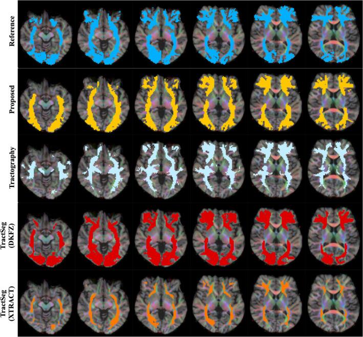 https://cdn.ncbi.nlm.nih.gov/pmc/blobs/2659/10826637/ec689c0a8211/HBM-45-e26578-g007.jpg