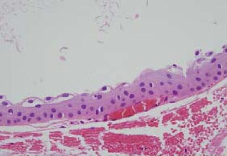 https://cdn.ncbi.nlm.nih.gov/pmc/blobs/265f/2629892/053b39cc7b44/kjo-21-251-g004.jpg