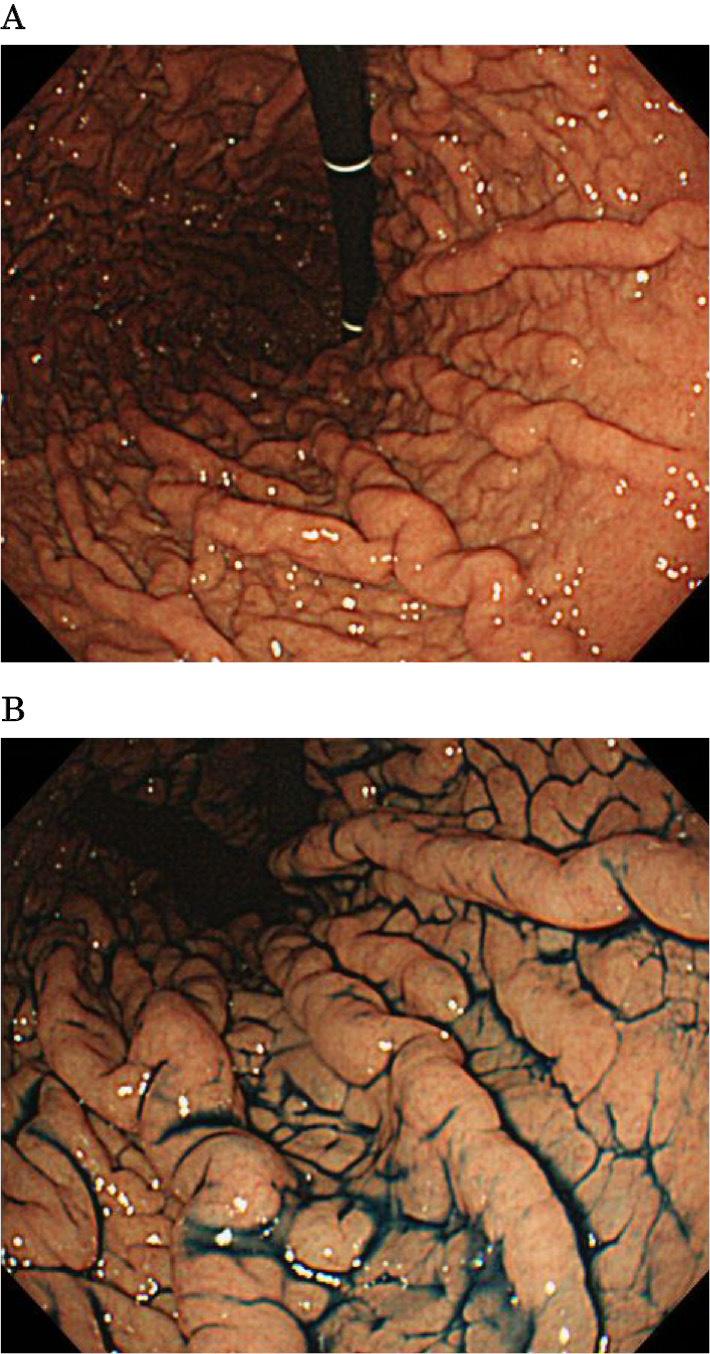 https://cdn.ncbi.nlm.nih.gov/pmc/blobs/2665/5675929/62b19e56ca12/1349-7235-56-2699-g001.jpg