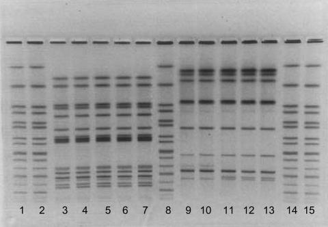 https://cdn.ncbi.nlm.nih.gov/pmc/blobs/2666/3320505/4a535a2d18a8/05-0111-F2.jpg