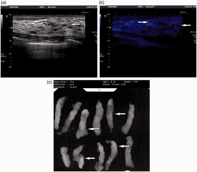 https://cdn.ncbi.nlm.nih.gov/pmc/blobs/266a/6124280/82208d8d22d4/10.1177_0300060518770577-fig2.jpg
