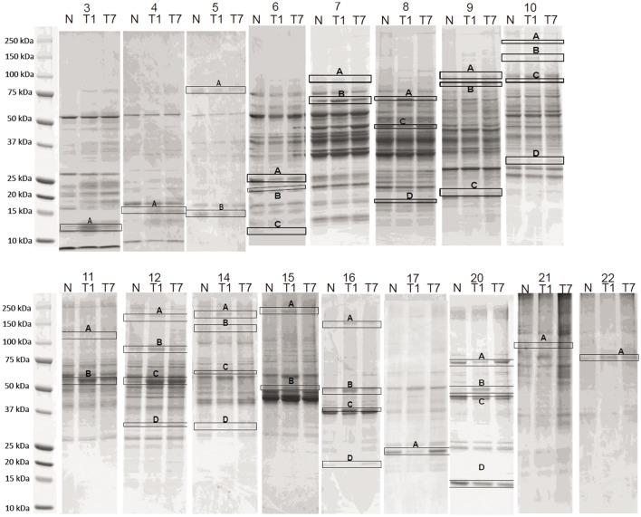 https://cdn.ncbi.nlm.nih.gov/pmc/blobs/266b/5118702/26b626234eb1/fneur-07-00198-g003.jpg