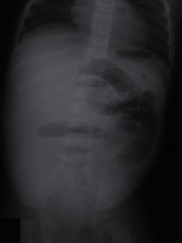 https://cdn.ncbi.nlm.nih.gov/pmc/blobs/266c/7875629/01062799ffd4/CRIPE2021-8815907.001.jpg