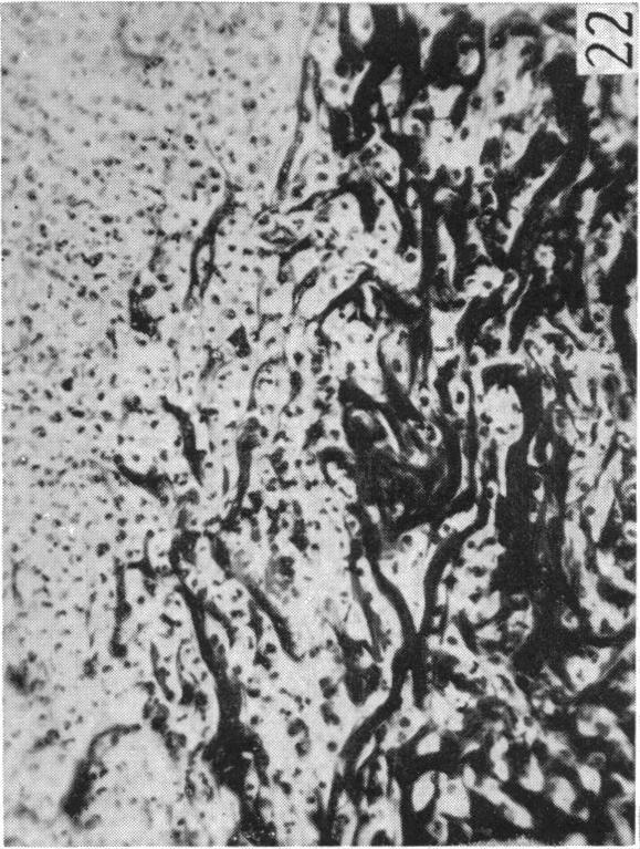 https://cdn.ncbi.nlm.nih.gov/pmc/blobs/266d/1252734/941a5298bfde/janat00509-0063-e.jpg