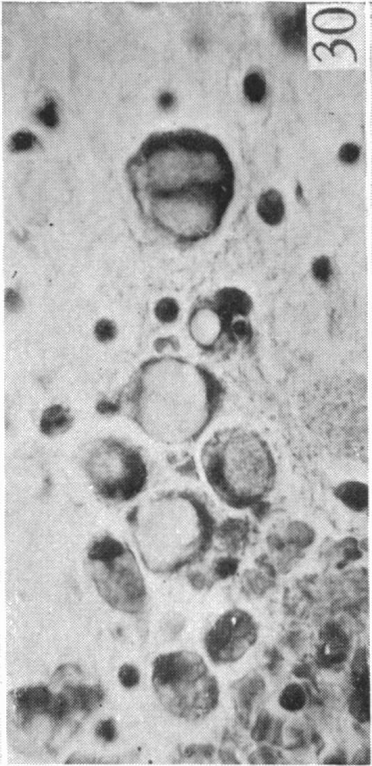 https://cdn.ncbi.nlm.nih.gov/pmc/blobs/266d/1252734/cbbd63240b78/janat00509-0064-g.jpg