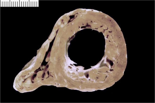 https://cdn.ncbi.nlm.nih.gov/pmc/blobs/2672/8298245/04a6354be7db/428_2021_3038_Fig9_HTML.jpg