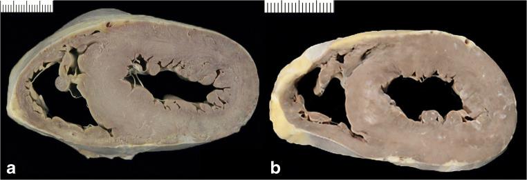 https://cdn.ncbi.nlm.nih.gov/pmc/blobs/2672/8298245/232b23223f84/428_2021_3038_Fig7_HTML.jpg