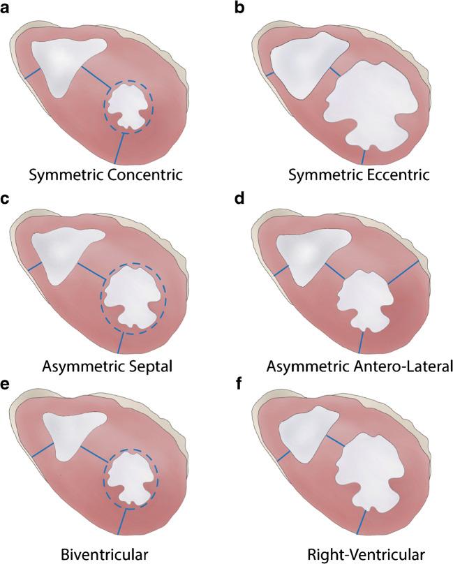 https://cdn.ncbi.nlm.nih.gov/pmc/blobs/2672/8298245/366fe53962f8/428_2021_3038_Fig3_HTML.jpg