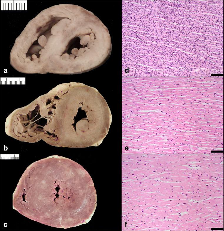 https://cdn.ncbi.nlm.nih.gov/pmc/blobs/2672/8298245/b750dfbd282c/428_2021_3038_Fig2_HTML.jpg
