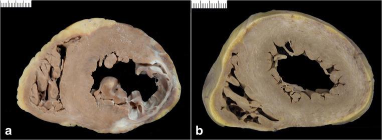 https://cdn.ncbi.nlm.nih.gov/pmc/blobs/2672/8298245/b902c0634816/428_2021_3038_Fig8_HTML.jpg