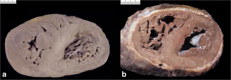https://cdn.ncbi.nlm.nih.gov/pmc/blobs/2672/8298245/ceb2027336fd/428_2021_3038_Fig10_HTML.jpg