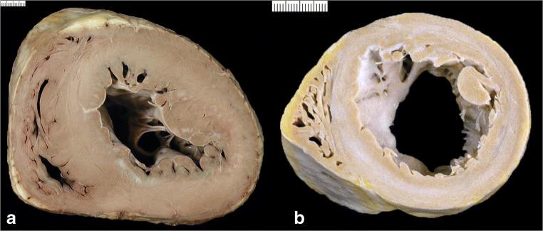 https://cdn.ncbi.nlm.nih.gov/pmc/blobs/2672/8298245/d00ca3b10036/428_2021_3038_Fig4_HTML.jpg