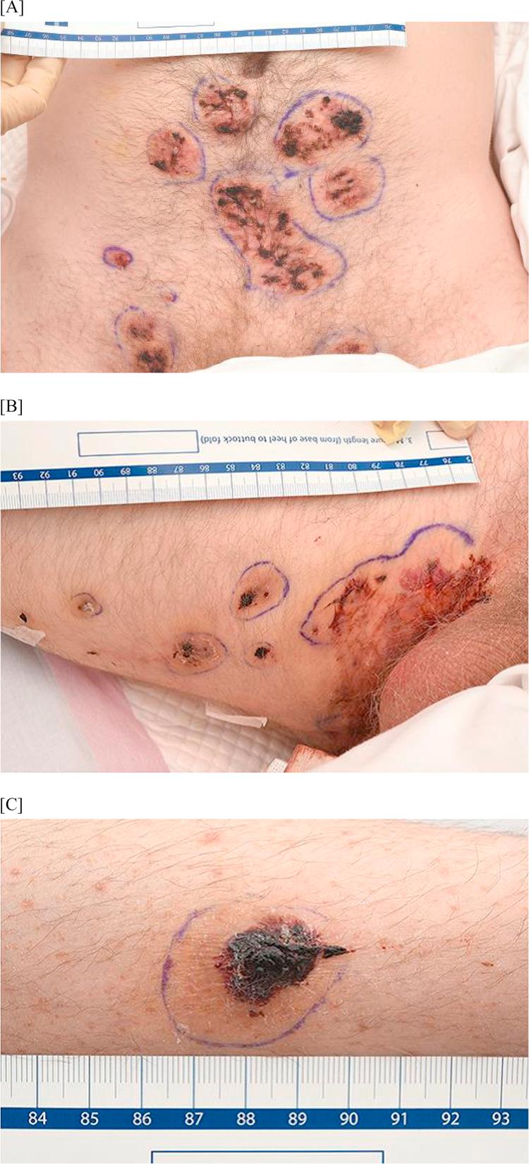 https://cdn.ncbi.nlm.nih.gov/pmc/blobs/2678/5502794/dc75fa14cc90/gr1.jpg