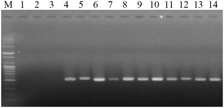 https://cdn.ncbi.nlm.nih.gov/pmc/blobs/267b/7476530/92efba52e5cc/TMYB_A_1785754_F0003_B.jpg