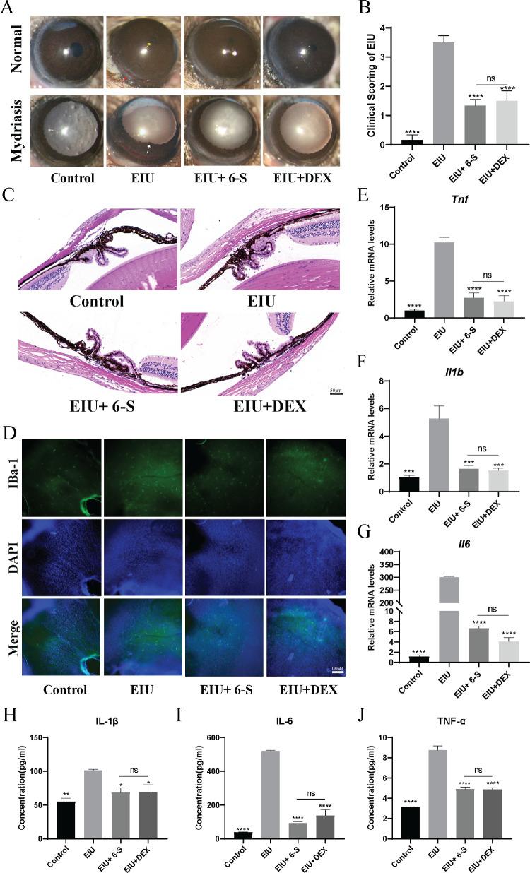 https://cdn.ncbi.nlm.nih.gov/pmc/blobs/267f/12273885/704e8feed2c4/iovs-66-9-43-f001.jpg