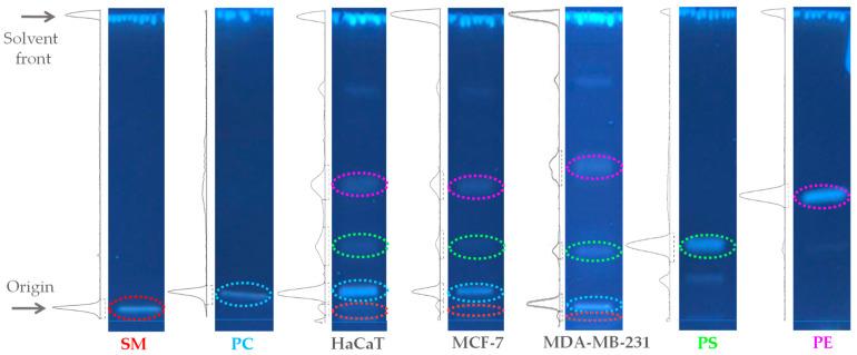 https://cdn.ncbi.nlm.nih.gov/pmc/blobs/2684/10671781/4a2bd7458c3b/ijms-24-16226-g001.jpg