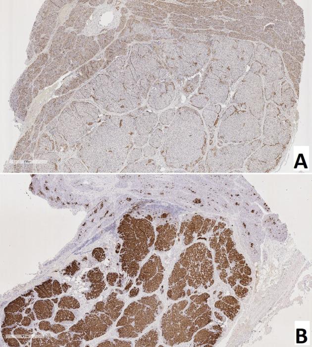https://cdn.ncbi.nlm.nih.gov/pmc/blobs/2689/8419459/914d0ed0f3a4/fendo-12-710947-g010.jpg