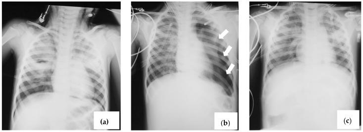 https://cdn.ncbi.nlm.nih.gov/pmc/blobs/268a/11435620/8836658db640/viruses-16-01347-g002.jpg