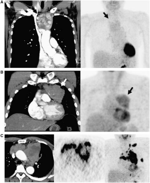 https://cdn.ncbi.nlm.nih.gov/pmc/blobs/268f/3266585/be4572ef9968/ci11002801.jpg