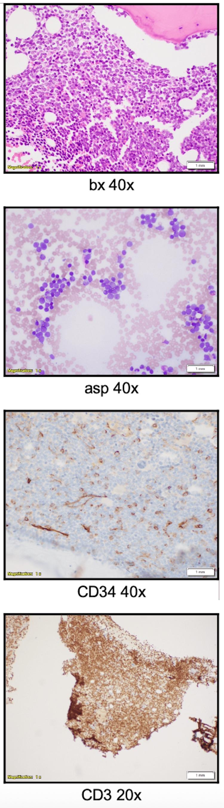 https://cdn.ncbi.nlm.nih.gov/pmc/blobs/2692/12221112/bf7e07c99b6e/cureus-0017-00000085214-i03.jpg
