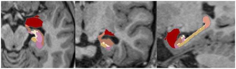 https://cdn.ncbi.nlm.nih.gov/pmc/blobs/2695/11405240/07df8f535b50/fnagi-16-1459652-g005.jpg