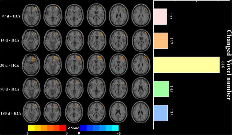 https://cdn.ncbi.nlm.nih.gov/pmc/blobs/2695/7533550/dea2306b8dfd/fnins-14-526645-g004.jpg