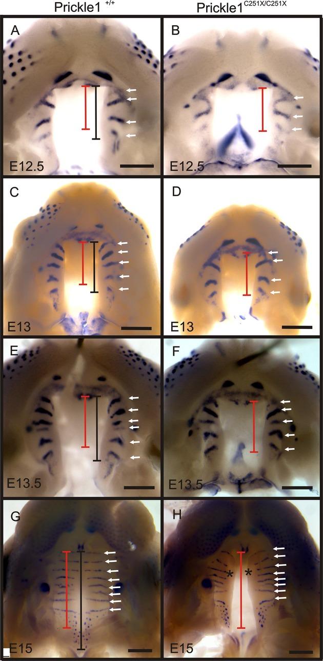 https://cdn.ncbi.nlm.nih.gov/pmc/blobs/2698/3960056/296a2494b38c/mgg30002-0138-f6.jpg