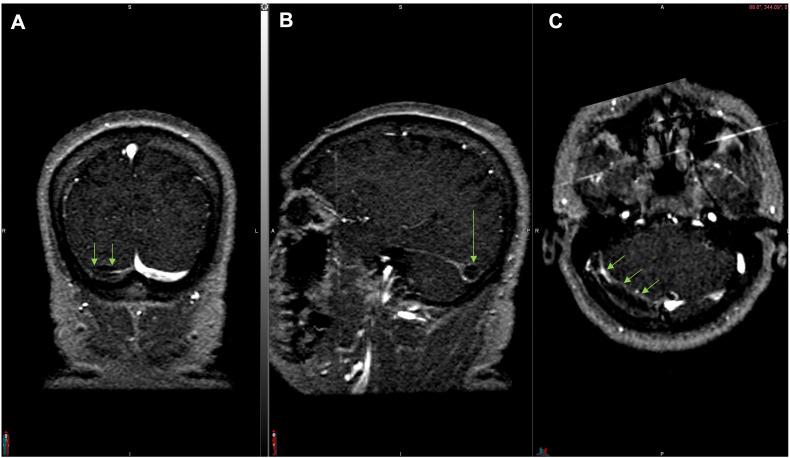 https://cdn.ncbi.nlm.nih.gov/pmc/blobs/269a/9283127/50f51d259f51/gr3_lrg.jpg