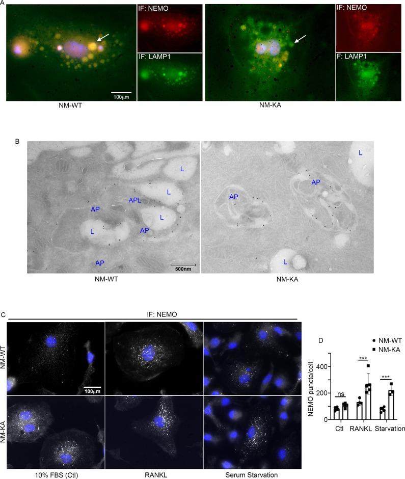 https://cdn.ncbi.nlm.nih.gov/pmc/blobs/26a1/7145425/dc1d0486c59c/elife-56095-fig5.jpg