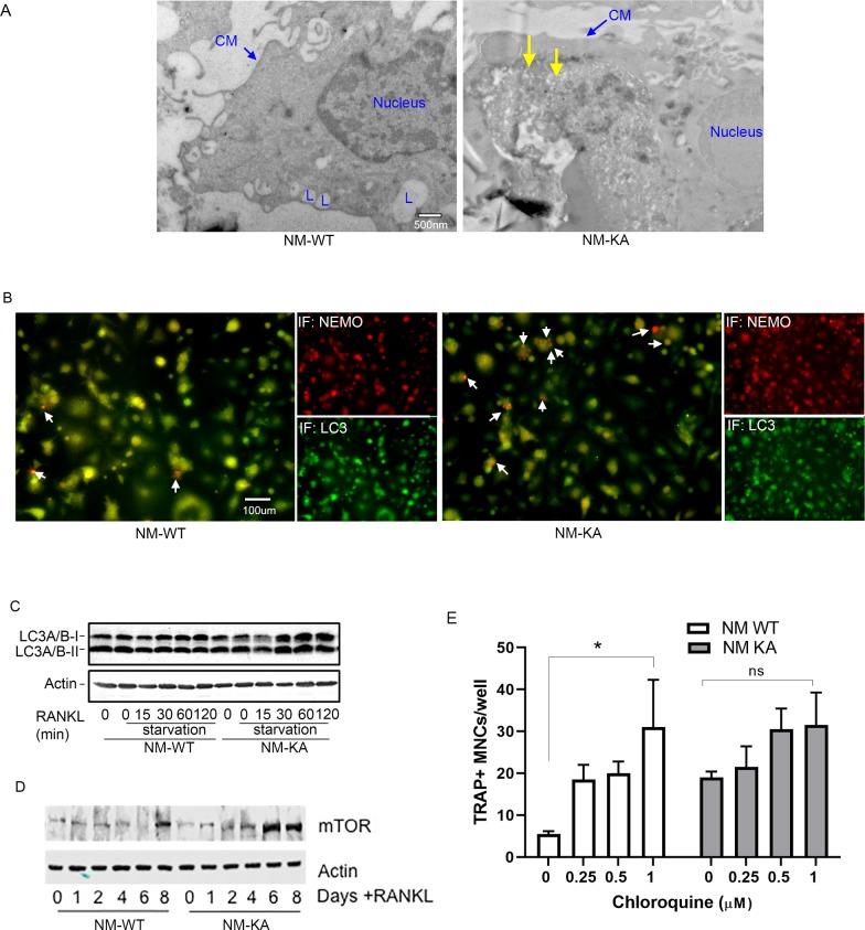 https://cdn.ncbi.nlm.nih.gov/pmc/blobs/26a1/7145425/ec3be1a93e7d/elife-56095-fig4-figsupp1.jpg