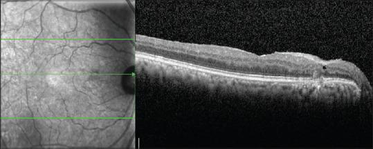 https://cdn.ncbi.nlm.nih.gov/pmc/blobs/26a7/7508106/defd69858744/IJO-68-1201-g005.jpg
