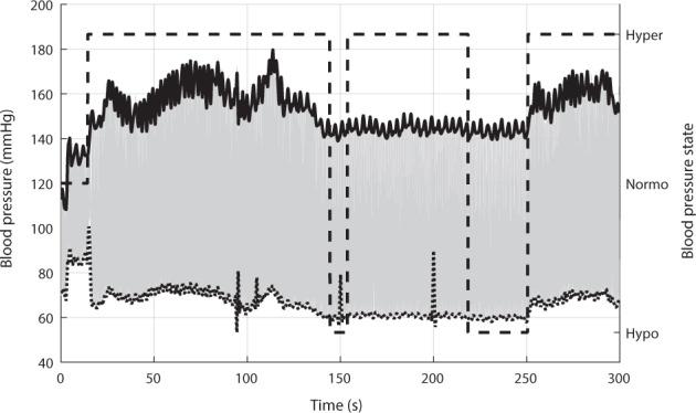 https://cdn.ncbi.nlm.nih.gov/pmc/blobs/26a7/8121822/5702769a87c4/41746_2021_447_Fig5_HTML.jpg