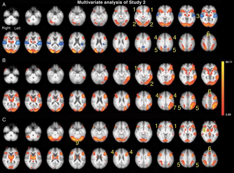 https://cdn.ncbi.nlm.nih.gov/pmc/blobs/26b7/4816781/275ebe4b59e2/bhu32505.jpg