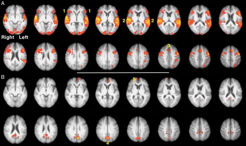 https://cdn.ncbi.nlm.nih.gov/pmc/blobs/26b7/4816781/e1bd32c7fb78/bhu32507.jpg