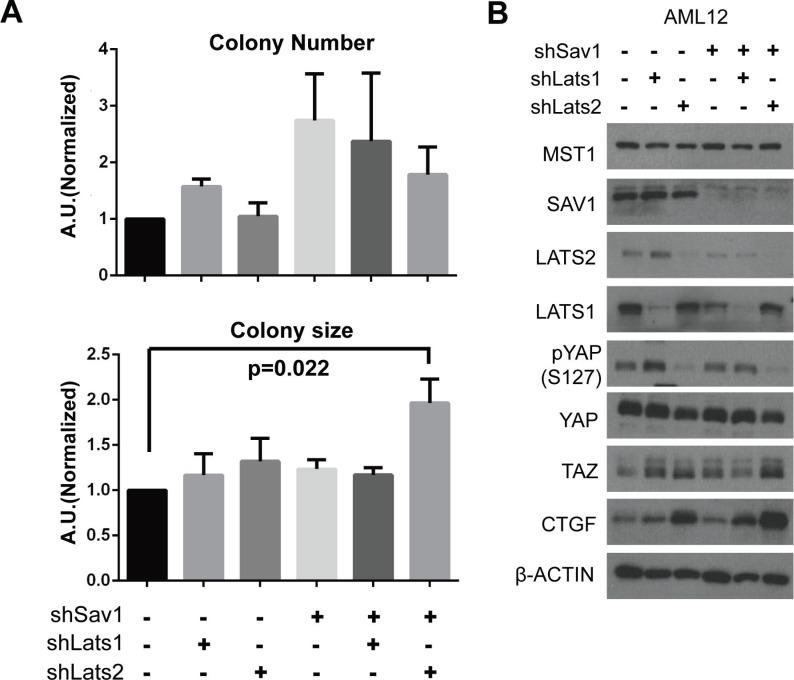 https://cdn.ncbi.nlm.nih.gov/pmc/blobs/26b8/5029684/7dff51b43f29/oncotarget-07-24063-g004.jpg