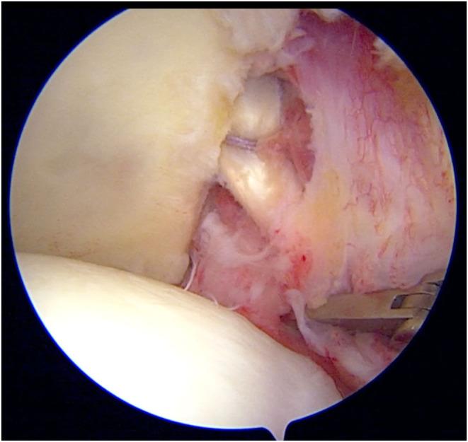 https://cdn.ncbi.nlm.nih.gov/pmc/blobs/26bb/11195335/3df2bc03a77e/EOR-24-0011fig4.jpg