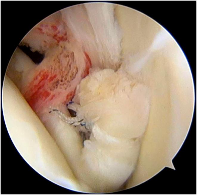 https://cdn.ncbi.nlm.nih.gov/pmc/blobs/26bb/11195335/c03b260b33b8/EOR-24-0011fig3.jpg