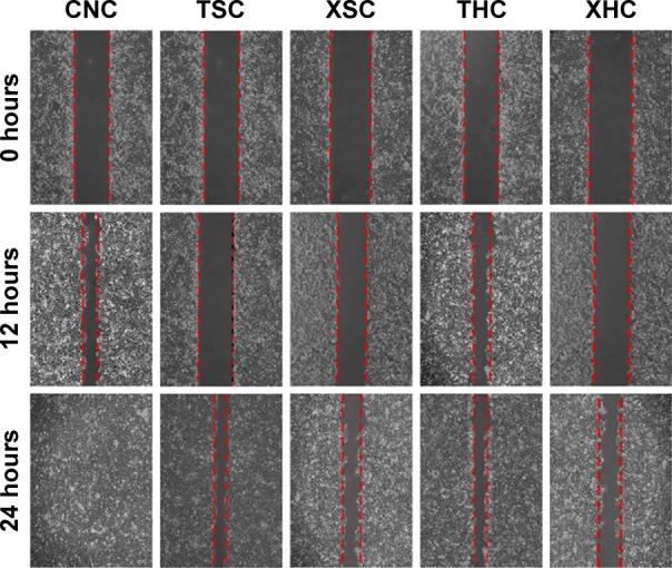 https://cdn.ncbi.nlm.nih.gov/pmc/blobs/26bb/4918735/2788200214cf/ott-9-3603Fig5.jpg