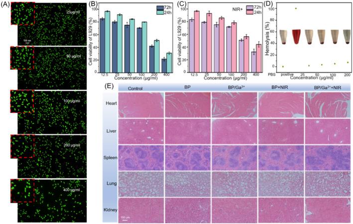 https://cdn.ncbi.nlm.nih.gov/pmc/blobs/26c1/11184645/d1e74c0276d7/IWJ-21-e14940-g001.jpg
