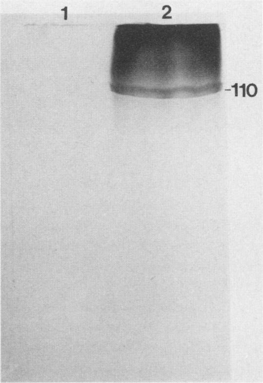 https://cdn.ncbi.nlm.nih.gov/pmc/blobs/26c1/258463/53f86a55225c/iai00050-0091-a.jpg